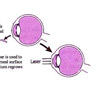 Coresub_FullstryImg_Phy_23_refraction_&_sight